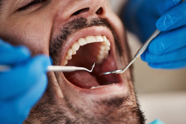 TMJ/TMD Treatment in Waterbury, CT